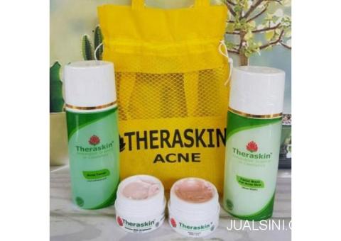 cream jerawat yan cream theraskin acne